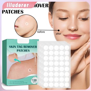 120 ชิ้น/กล่อง Warts Remover Patch ปลอดภัยไม่เจ็บปวดหมวดหมู่แพทช์ Wart Treatment Patch Fast Acting Remover หูดตุ่นความงาม HO