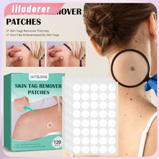 120pcs Warts Remover Patch ปลอดภัยไม่เจ็บปวดหมวดหมู่แพทช์สิว Wart Treatment Patch Fast Acting Remover หูดตุ่น HO