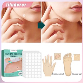 Warts Remover Patch ปลอดภัยไม่เจ็บปวดแท็กผิวแพทช์สิว Wart Treatment Patch Fast Acting Remover Warts Moles HO