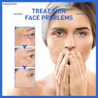 【Syj】 Botox Stock Solution เซรั่มบํารุงผิวหน้า ต่อต้านริ้วรอย กระชับผิว TH