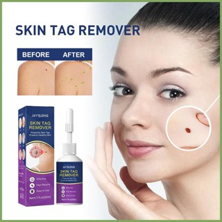 wart remover หยดยากำจัดหูดแบบธรรมชาติ ไม่เจ็บ ไม่เป็นแผล ใช้ง่ายบนใบหน้า คอ ลำตัว มือ เท้า