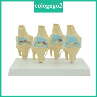 Cologogo2 โมเดลข้อต่อเข่า ลดขนาดมนุษย์ พร้อมฐานรอง