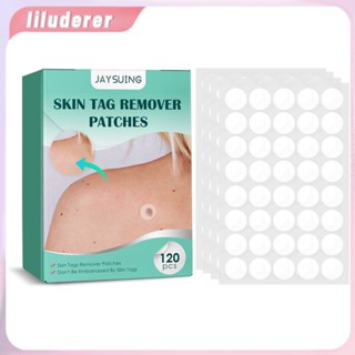 120pcs Warts Remover Plaster แท็กผิว Remover Wart Treatment Patch สารสกัดจากสมุนไพรข้าวโพดพลาสเตอร์ HO