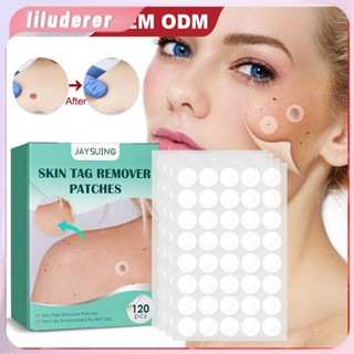 120 ชิ้น/กล่อง Jaysuing Skin Tag Remover แพทช์หูด Remover Patch Wart Remover Kit HO