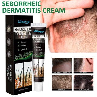 Seborrhoeic Dermatitis Scalp Care Treatment Cream for Anti-Itch Soothing Relief