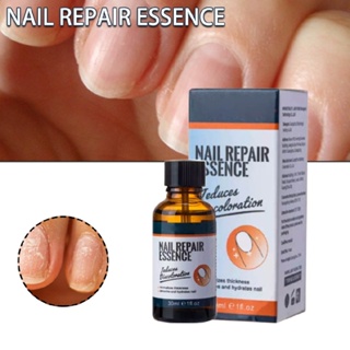 Nail Repair Essence Nail Treatment Effective Repair Solution for Damaged Nails