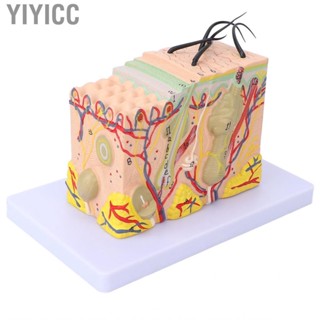 Yiyicc 35X Enlarged Anatomical Skin Model 3 Dimensional Teaching Aids JFF