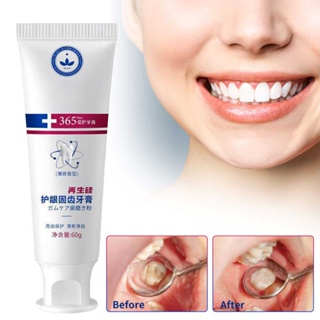 Anti-Cavity Gum Health Toothpaste, Active Remineralization Toothpaste UK