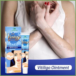 ครีม Vitiligo, ครีมดูแลเฉพาะจุดและดูแลสุขภาพ, ครีมตาข่ายจุดขาว, จุดเหงื่อ, ครีมเฉพาะที่ผิว vitiligo