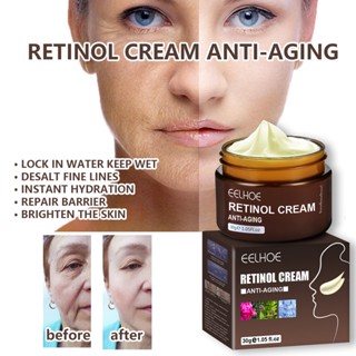 Eelhoe Retinol ครีมต่อต้านริ้วรอย 30 กรัม ต่อต้านริ้วรอย ยกกระชับผิวหน้า