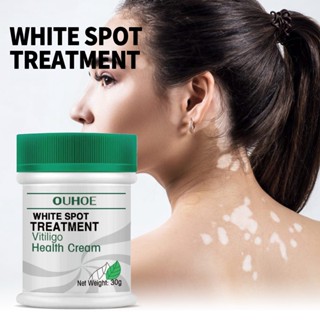 Hot Sale# OUHOE white spot repair cream repair fade white spot melanin hand and foot skin Moss skin external care cream 3/23 ~