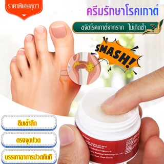 ครีมรักษาโรคเกาต์/ครีมรักษาโรคเกาต์