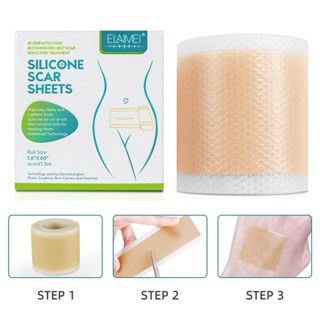 Tiktok hot# ELAIMEI scar roll sticker self-adhesive scar sticker stretch marks scald cesarean operation scar care sticker 1M58.31zs