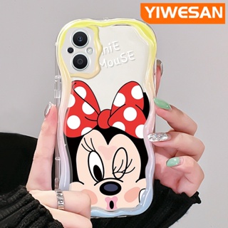 เคสโทรศัพท์มือถือ ซิลิโคนนุ่ม ใส กันกระแทก ลายการ์ตูนมินนี่เมาส์น่ารัก สําหรับ OPPO Reno 7Z 5G Reno 8Z Reno7 Lite Reno8 Lite F21 Pro 5G F21s Pro 5G