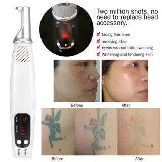 Mother &amp; Baby Handheald Red Light Picosecond ปากกาเลเซอร์ แผลเป็น ลบรอยสัก อุปกรณ์ความงามเจือจางเมลานิน