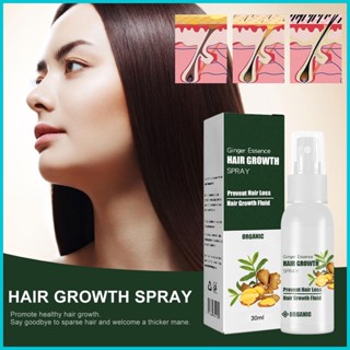 Ginger Hair Regrowth เอสเซ้นขิง เอสเซ้นส์ผมร่วง หนา 20 มล. เพิ่มความชุ่มชื้น สําหรับเส้นผม