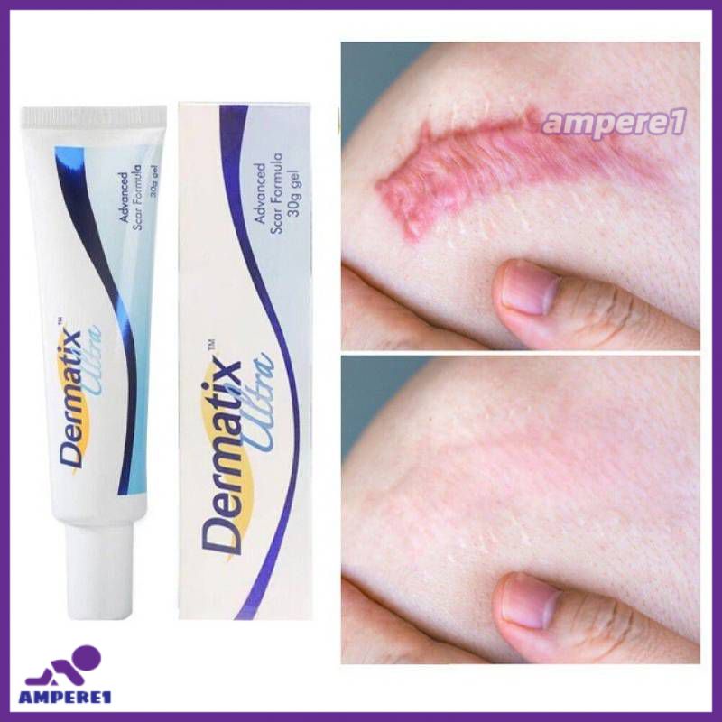 Formula Dermatix Ultra Advance Scar Cream ลบเลือนรอยแผลเป็น (15g) -AME1 -AME1