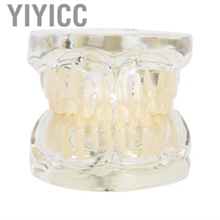 Yiyicc Dental Implant Restoration Typodont  Model Removable Study Demo