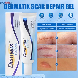 Dermatix Ultra Scar Remover Scar Gel Scar Remover Effectiv Treatment Scar 15g สำหรับเด็ก Scar Remover Cream Linklink