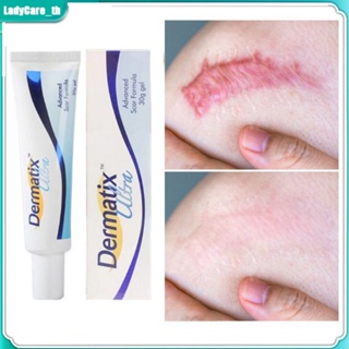 Dermatix Ultra Beishu Gel ครีมเจลซ่อมแซมรอยแผลเป็น รอยแผลเป็น อเนกประสงค์