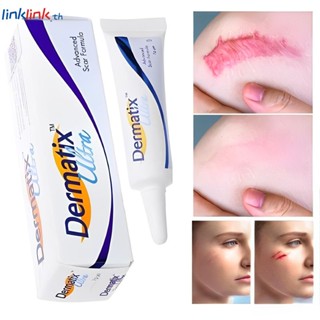 Dermatix ครีมกำจัดรอยแผลเป็นสำหรับรอยแผลเป็นเก่ารอยแผลเป็นใหม่คลอดบุตร Stretch Marks เจลผิวสิว SCAR Repair ไขมัน Striae รักษา care 15g Linklink