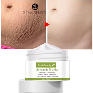 Anyi Beauty ครีมซ่อมแซมหลังคลอด Natural Anti-stretch Marks Cream Stretch Marks Repair Cream TECH3