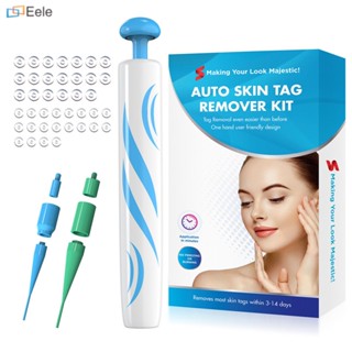 2in1 Auto Skin Tag Mole Wart Removal Kit 40x ยางรัด 10x แผ่นแอลกอฮอล์ Professionalgrade เชื่อถือได้ขั้นสูง ปลอดภัย และมีประสิทธิภาพ กำจัดไฝ รวดเร็วและมีประสิทธิภาพ (จัดส่งในวันนี้)