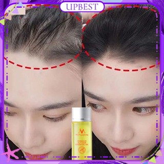 ♕ Meiyanqiong โมร็อกโก Nut Hair Growth Essential Oil Anti-hair Loss Promote Hair Growth Repair Moisturizing Scalp Hair Root Essence Men Women Hair Care 20ml UPBEST