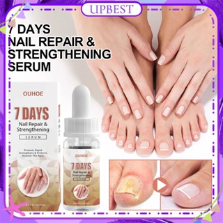 ♕ Ouhoe 7-day Nail Repair Essence บรรเทามือเท้า Onychomycosis สดใสเล็บนุ่มป้องกันเชื้อรา Liquid ส่วนผสมธรรมชาติ Body Care 20ml UPBEST