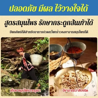 เอ็นร้อยหวายอักเสบบรรเทาอาการปวดสเปรย์ สเปรย์บรรเทาปวดส้นเท้า