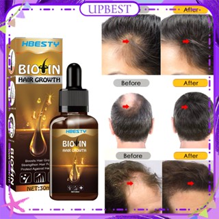 ♕ Hbesty Bioin Hair Essential Oil โรสแมรี่ขิงส่งเสริมการเจริญเติบโตของเส้นผมป้องกันผมร่วงซ่อมแซมรากนวดหนังศีรษะ Essence Men Women Hair Care 30ml UPBEST