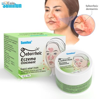 Sumifun Seborrheic Dermatitis Cream FastActing บรรเทาอาการคันหนังศีรษะแห้ง Body Treatment สำหรับกลากรูขุมขนและโรคผิวหนัง 30g หลอด (จัดส่งวันนี้)