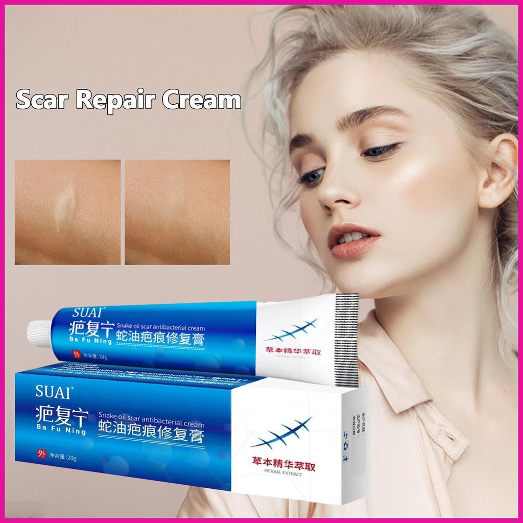 Scar Repair Cream Quick Healing For Face Burns Injuries Scar Cream For Face And Body Marks Removal Cream