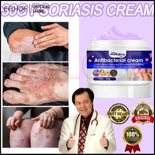 South Moon Anti Bacterial Eczemaครีมป้องกันอาการคันเหงื่อHerpes Treatment Psoriasis Creamโรคสะเก็ดเงินSkin Careครีม-eelhoe