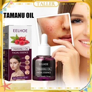 ✧Ready Stcok Eelhoe Tamanu Oil Facial Essenceกำจัดสิวรูขุมขนหดตัวปิดปากต่อต้านริ้วรอยซ่อมแซมผิวเซรั่มบำรุงผิวหน้าFace Care 20Mlสูง