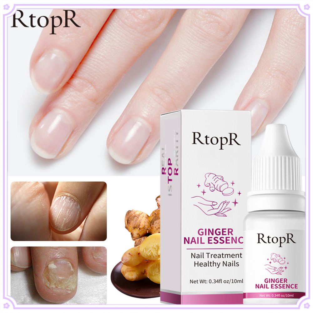 Rtopr เล็บขิงเซรั่มต้านเชื้อแบคทีเรีย NAIL Repair Essence เซรั่ม Fungal NAIL Treatment ลบ Onychomycosis เล็บเท้า Nourishing Foot Care