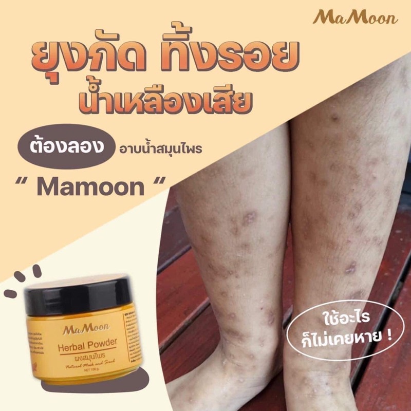 ปราบยุง Ma Moon ขมิ้นผงสมุนไพรอาบน้ำเด็กมามูน ผิวแพ้ง่าย ลดผดผื่นรอยยุงใช้ได้ตั้งแต่แรก