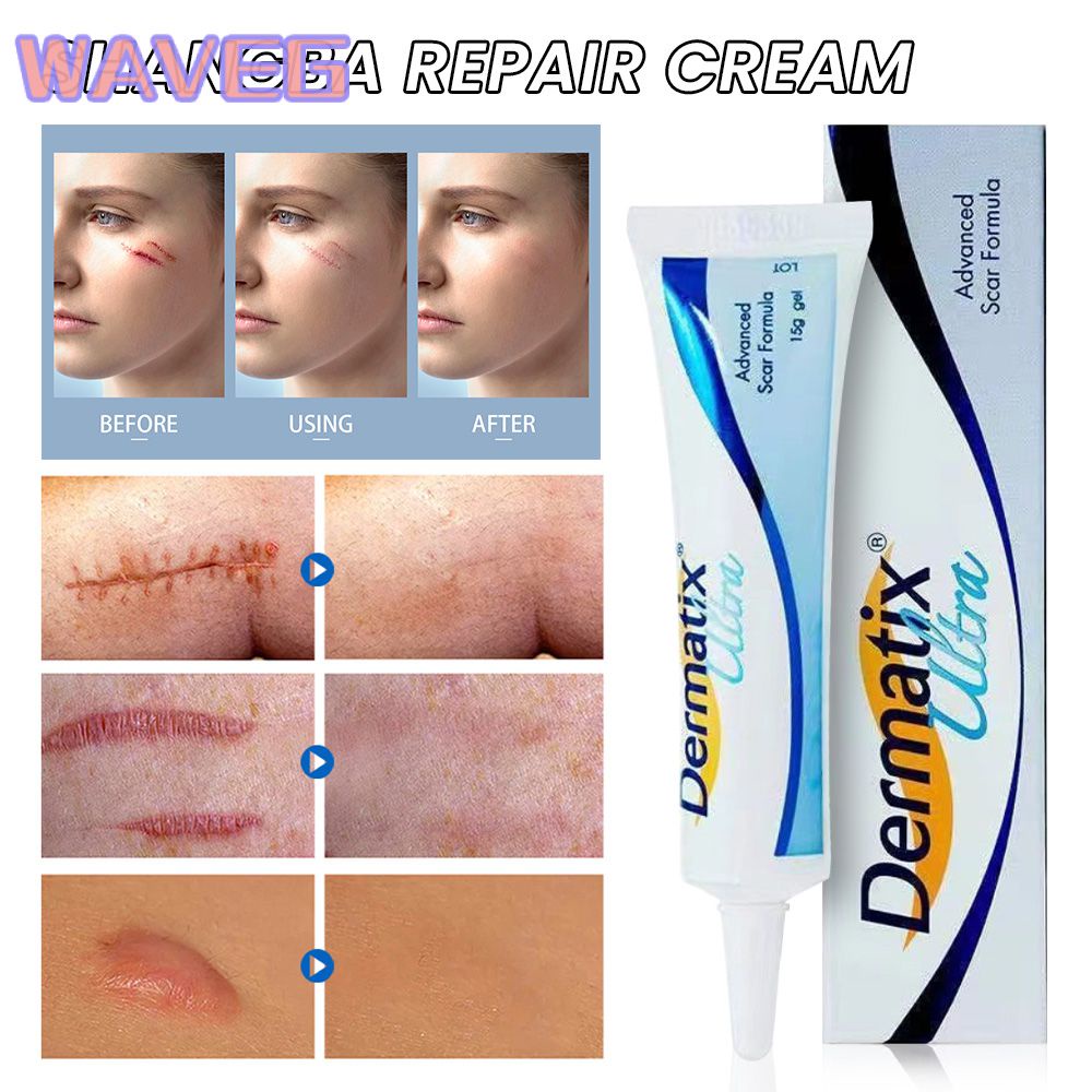 Wave Dermatix Ultra Gel Scar Removal Repair Skin Care สิวลบเครื่องหมายยืด Scar Gel 15g Skin Care