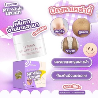 ครีมทาง่ามขาแอนนา + ของแถม ของแท้💯 Crown Me White Cream ครีมทาขาหนีบ ครีมแก้ง่ามดำ ครีมทาง่ามขา ครีมทารักแร้ ครีมทาก้น