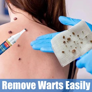 Warts Remover ของแท้ น้ํามันถั่วเหลือง วอร์ท กําจัดวอร์ท และแท็ก ผิวหนัง ครีมหูด วอร์ท เมจิก กําจัด แท็ก ผิว การเจริญเติบโต ไฝ และวอร์ท กําจัดหูด ทรีทเม้นท์