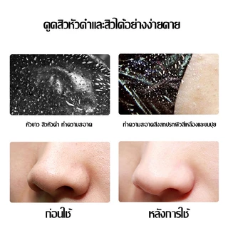 มาส์กขจัดสิวเสี้ยน ล่าก่อนสิวหัวดำ สิวเสี้ยน สิวจากมลภาวะต่างๆ มาส์คหน้าโคลนดำ 60g ลอกสิวเสี้ยน ลอกออกได้(743)