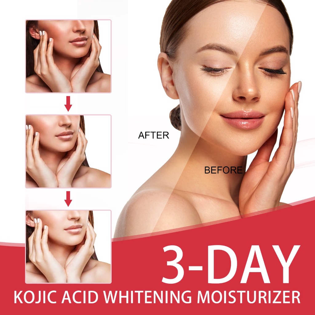 New 3 Days Kojic Acid Whitening Moisturizing Cream Body Lightening Cream 25g