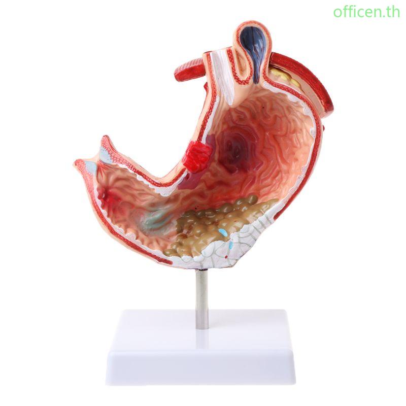 โมเดลกระเพาะอาหาร บรรเทาอาการปวดเมื่อยตามหลักสรีรศาสตร์มนุษย์