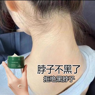 Spot seconds hair# neck underarm joint black knee neck lines face melanin hand elbow student black ratchet skin cleaning milk 8.cc