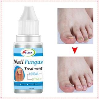 Blsex เชื้อราที่เล็บ Treatment Liquid Repair Onychomycosis Thicken นุ่มเล็บป้องกันการติดเชื้อ Antiแบคทีเรียกำจัด Solution Foot Body Care ผลิตภัณฑ์ 10ml JOYFEEL