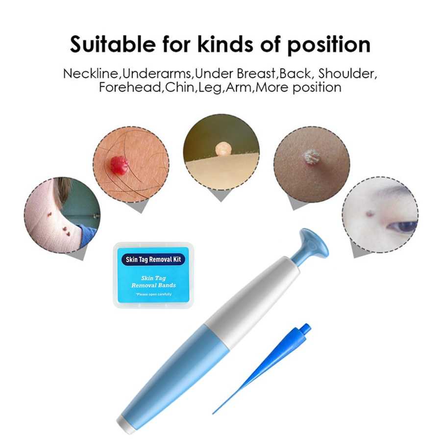 LEKGAVD เครื่องมือกําจัดหูดแท็กผิวที่ไม่เจ็บปวดชุดกําจัดไฝ - LGV40 "IbrahimaStoree"