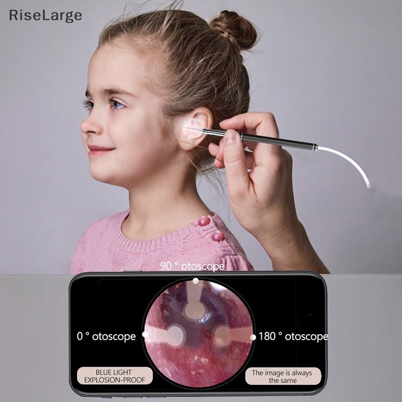 [RiseLarge] ใหม่ ไม้แคะหูอัจฉริยะ สําหรับทําความสะอาดหู กล้องเอนโดสโคป 1 ชุด