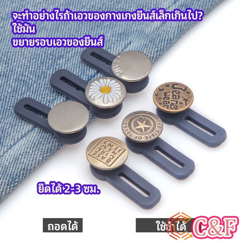 NKK กระดุมขยายเอว เพิ่มขนาดรอบเอวกางเกง สายบุฟเฟ่ต์ต้องไม่พลาด jeans buttons