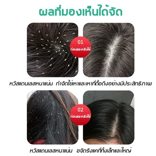 พร้อมส่ง 🔥หวีสางเหาไข่เหาก็หวีได้หมดขจัดเหาเป็นเรื่องง่ายเครื่องดูดเหา หวีเหาสางไข่เหาหวีดูดเหากำจัดเหาหวีเสนียดไฟฟ้า