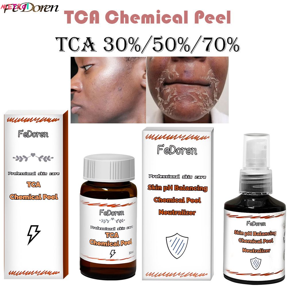 TCA 30% 50% 70% 30ml 50ml ( Skin Peeling Solution) ซ่อมแซมการกำจัดสิวและสิวจางลง สิว metro1